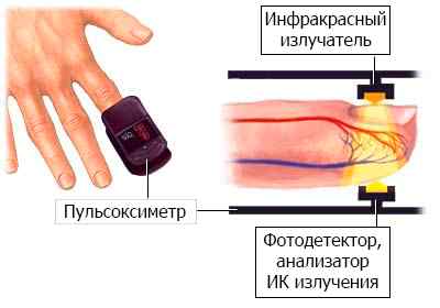 Пульсоксиметр Onyx 9550; Onyx Vantage 9590 (Nonin Medical Inc., США)